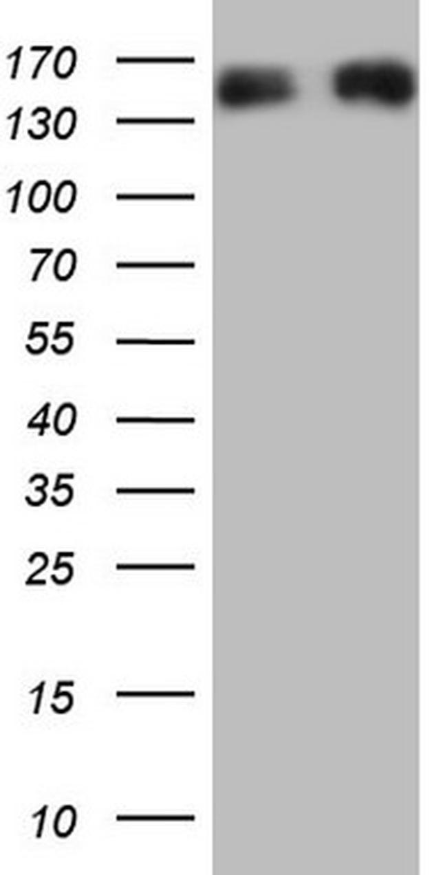 NEFM Antibody in Western Blot (WB)