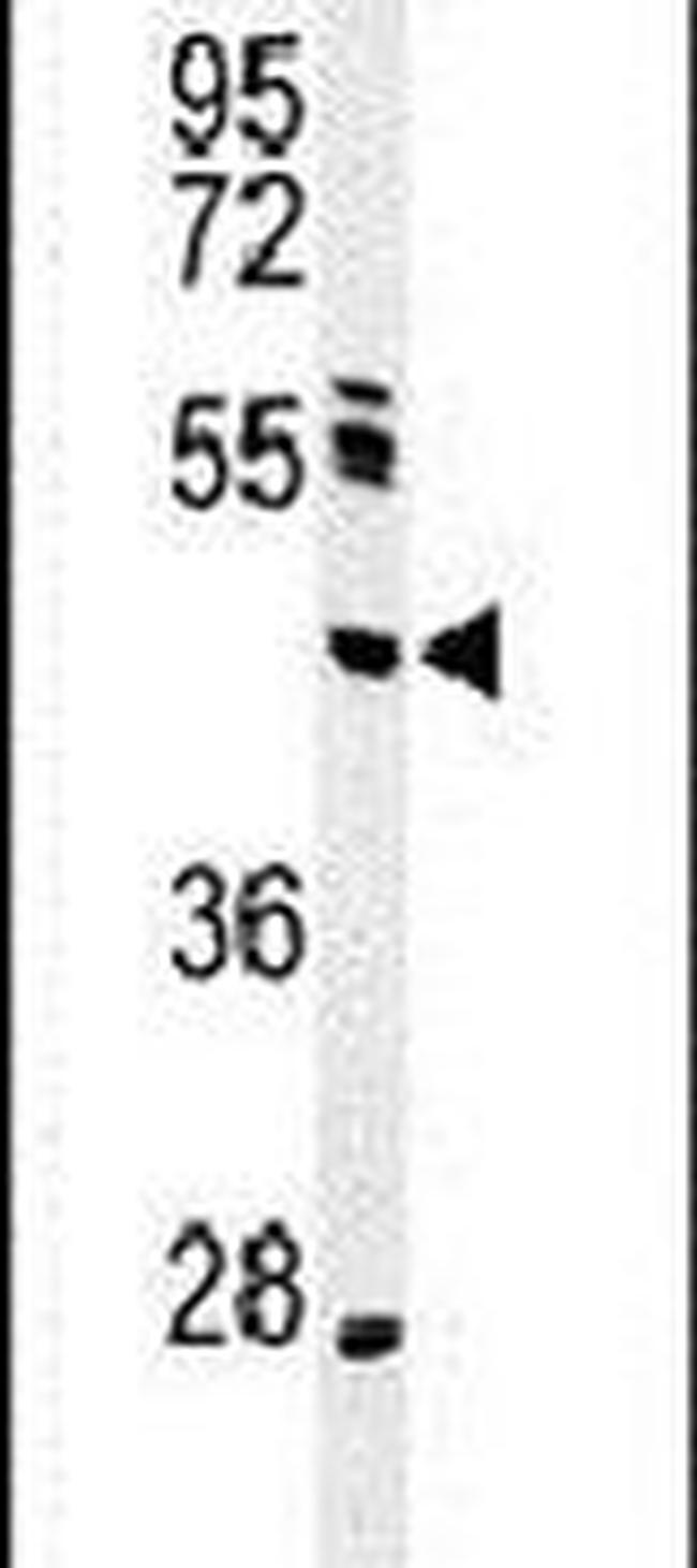 NEIL1 Antibody in Western Blot (WB)