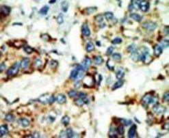 NEK4 Antibody in Immunohistochemistry (IHC)