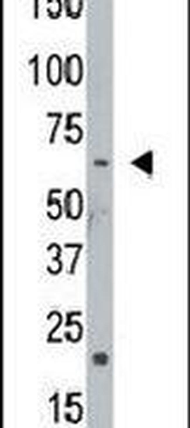 NEK8 Antibody in Western Blot (WB)