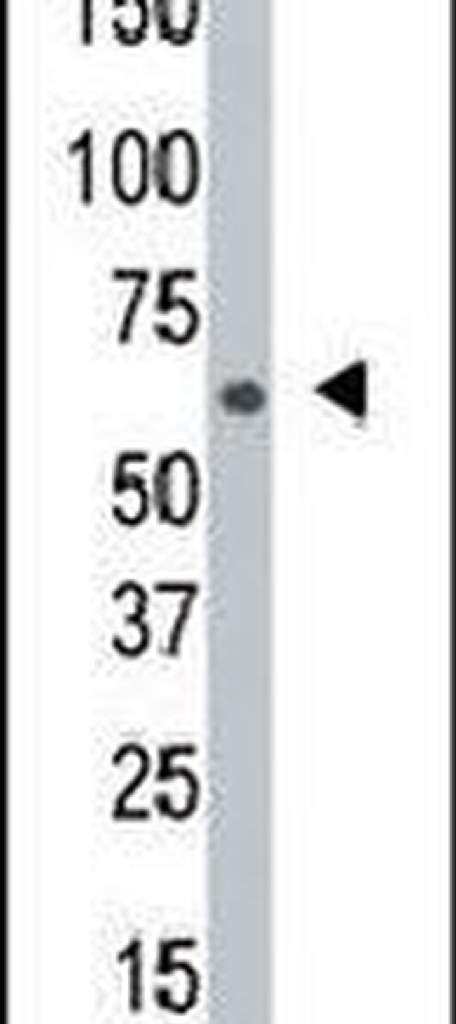 NEK8 Antibody in Western Blot (WB)