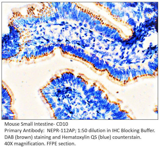 CD10 Antibody in Immunohistochemistry (IHC)