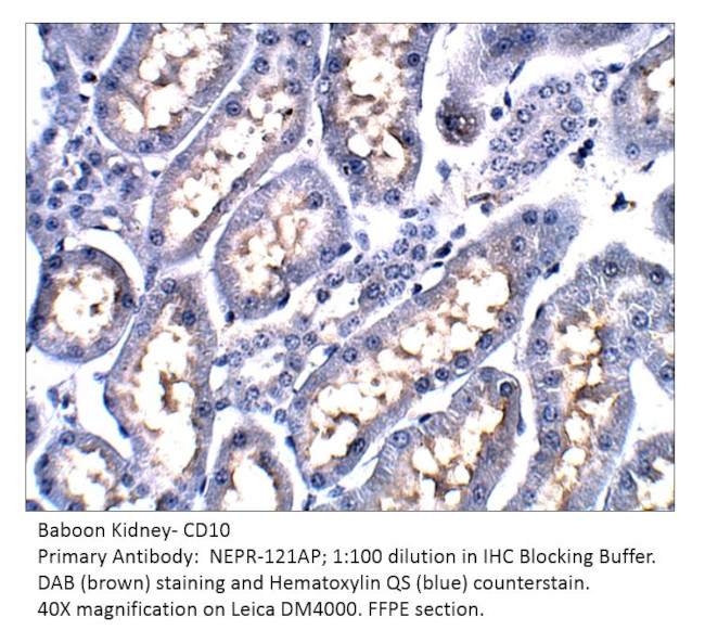 CD10 Antibody in Immunohistochemistry (IHC)