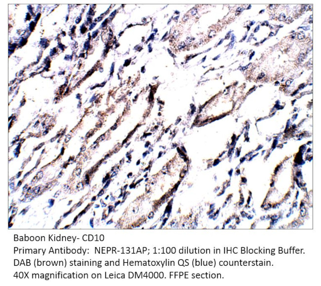 CD10 Antibody in Immunohistochemistry (IHC)