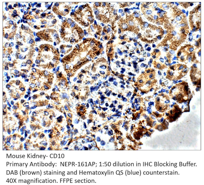 CD10 Antibody in Immunohistochemistry (IHC)
