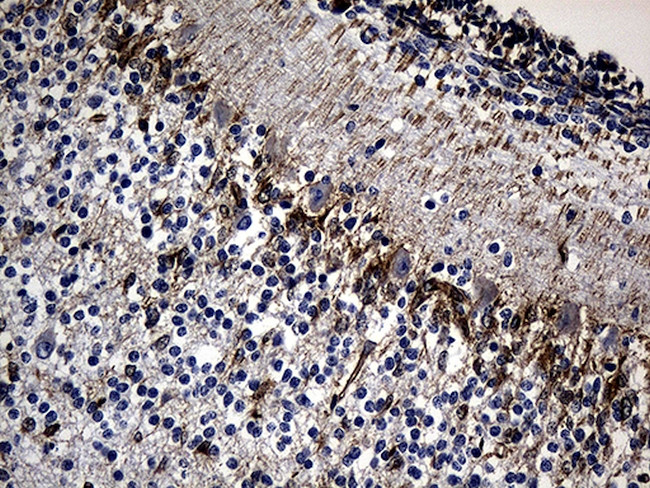 NES Antibody in Immunohistochemistry (Paraffin) (IHC (P))