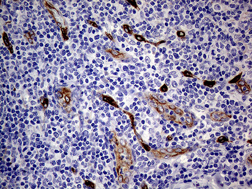 NES Antibody in Immunohistochemistry (Paraffin) (IHC (P))