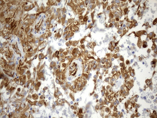 NES Antibody in Immunohistochemistry (Paraffin) (IHC (P))