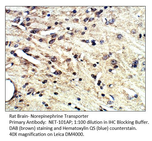 Norepinephrine Transporter Antibody in Immunohistochemistry (IHC)