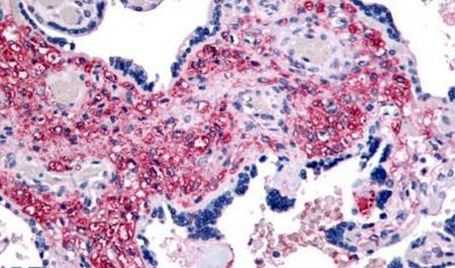 NET1 Antibody in Immunohistochemistry (Paraffin) (IHC (P))