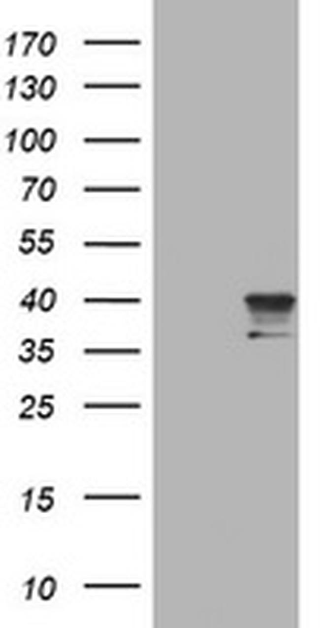NEU1 Antibody in Western Blot (WB)