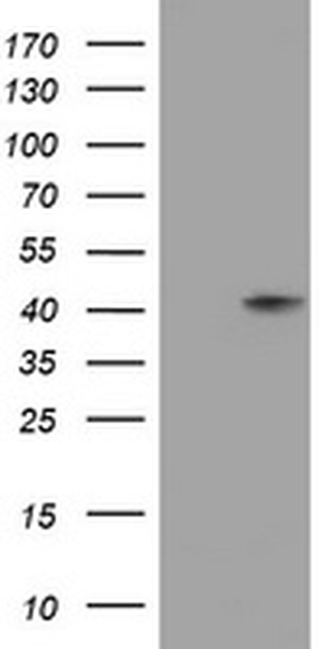 NEU1 Antibody in Western Blot (WB)