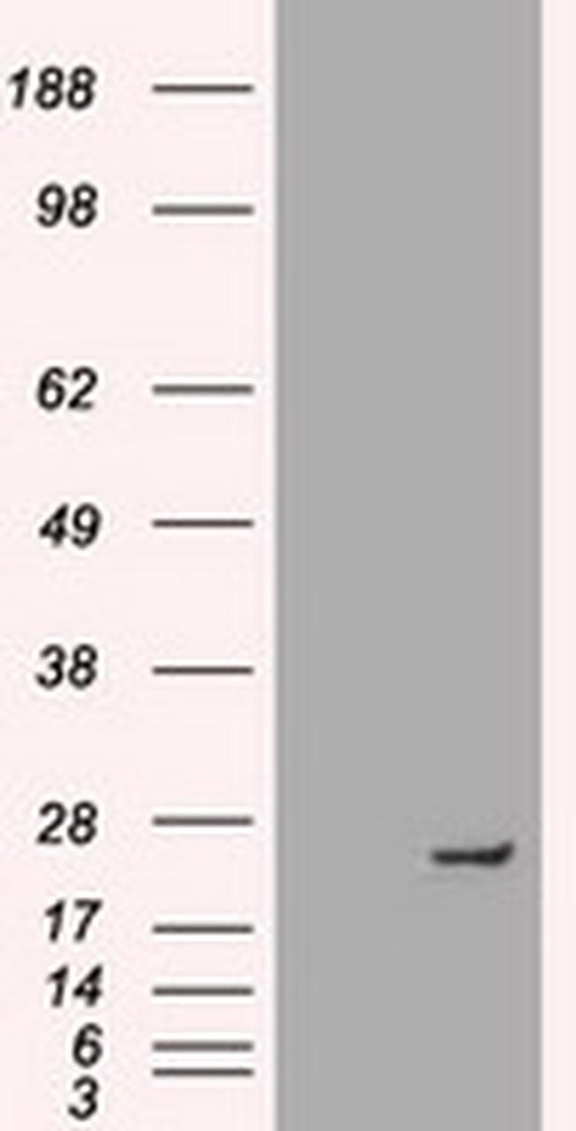 NEUROG1 Antibody in Western Blot (WB)