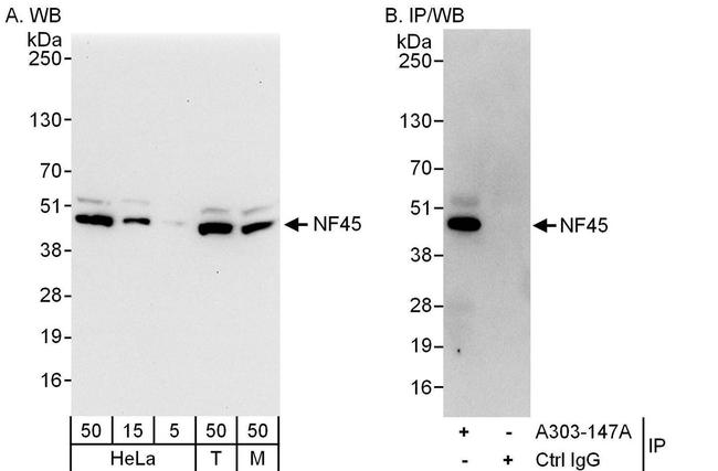 NF45 Antibody in Western Blot (WB)