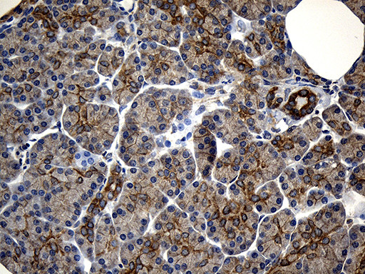NFKBIE Antibody in Immunohistochemistry (Paraffin) (IHC (P))
