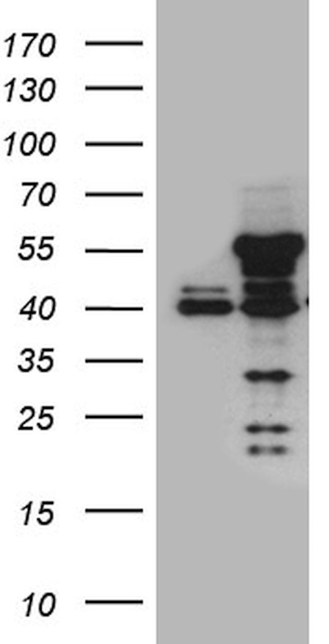 NFKBIE Antibody in Western Blot (WB)