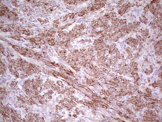 NFS1 Antibody in Immunohistochemistry (Paraffin) (IHC (P))