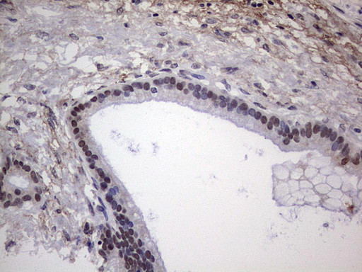 NHEJ1 Antibody in Immunohistochemistry (Paraffin) (IHC (P))