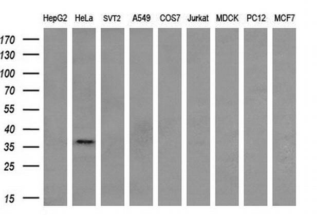 NHEJ1 Antibody in Western Blot (WB)