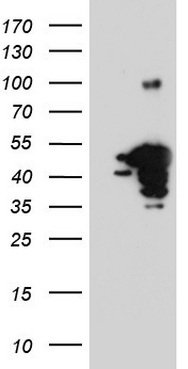 NHEJ1 Antibody in Western Blot (WB)