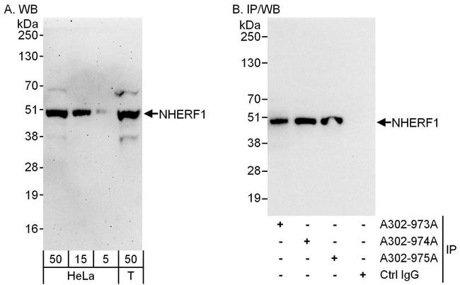 NHERF1 Antibody in Western Blot (WB)
