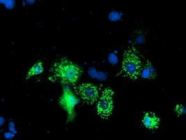 NIF3L1 Antibody in Immunocytochemistry (ICC/IF)