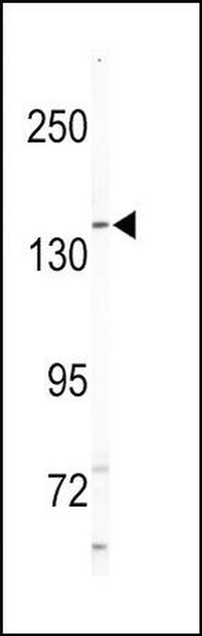 HGK Antibody in Western Blot (WB)
