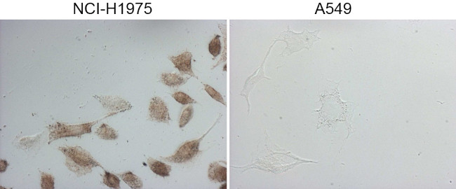 NKX2 Antibody in Immunocytochemistry (ICC/IF)