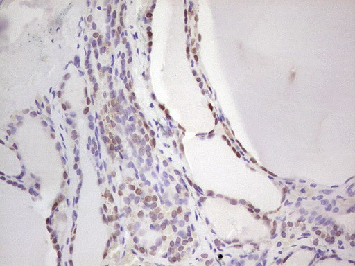 NKX2 Antibody in Immunohistochemistry (Paraffin) (IHC (P))