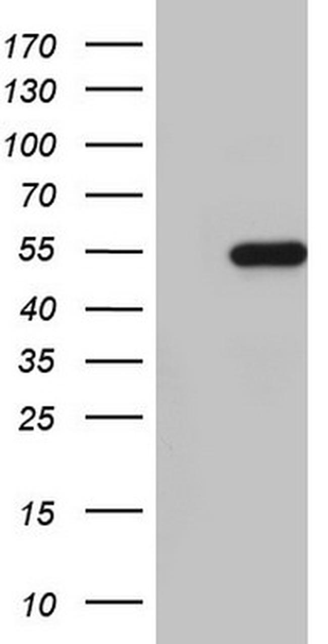 NKX2 Antibody in Western Blot (WB)