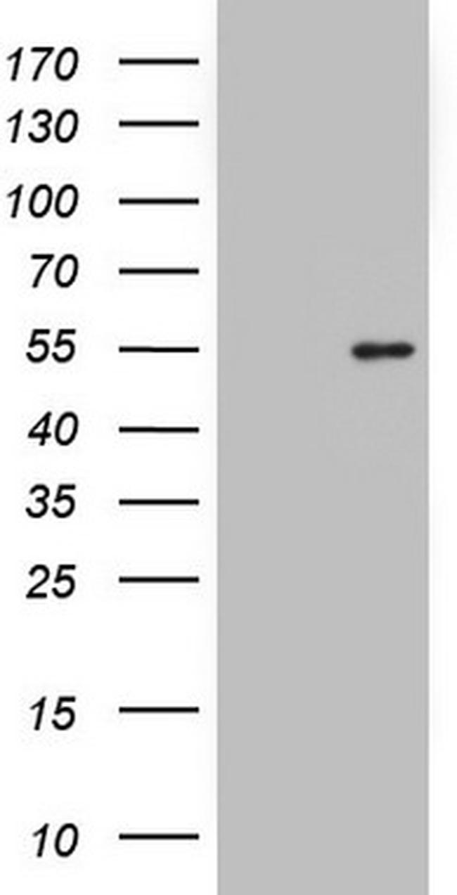 NKX2 Antibody in Western Blot (WB)