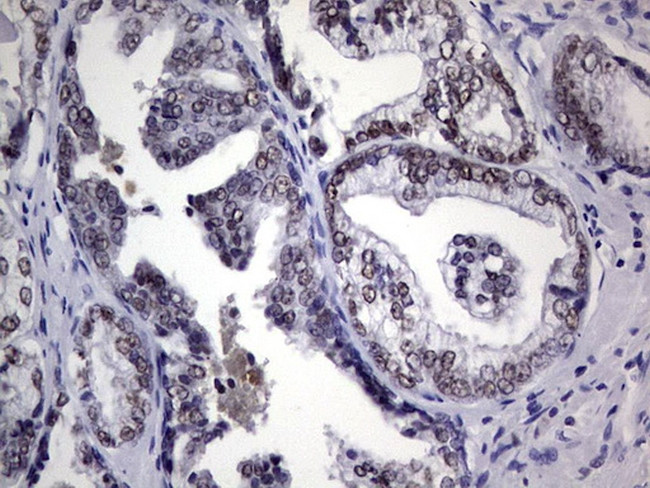 NKX3.1 Antibody in Immunohistochemistry (Paraffin) (IHC (P))