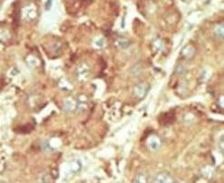 NLK Antibody in Immunohistochemistry (IHC)