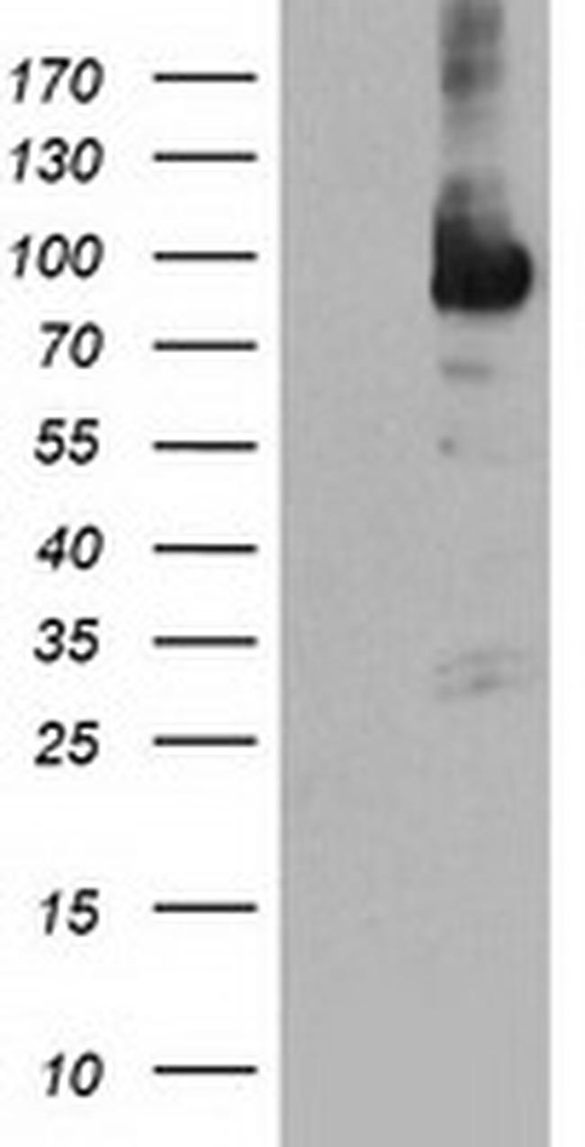 NLN Antibody in Western Blot (WB)