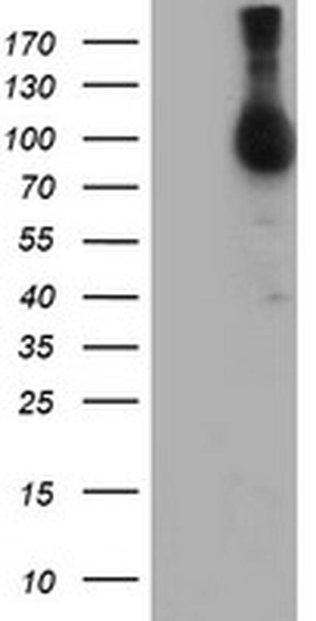 NLN Antibody in Western Blot (WB)
