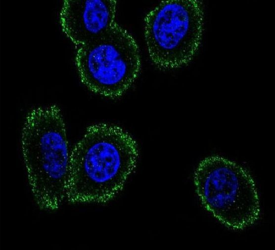 NMB Antibody in Immunocytochemistry (ICC/IF)