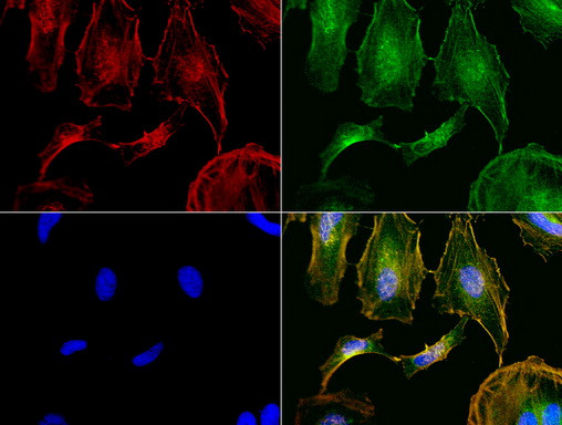 NME1 Antibody in Immunocytochemistry (ICC/IF)
