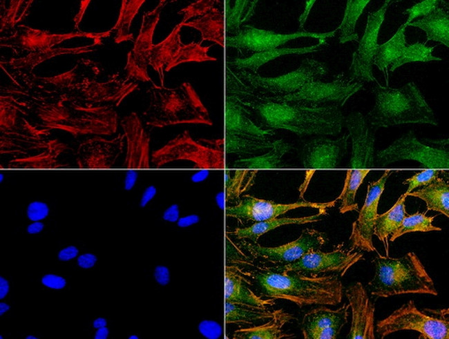 NME1 Antibody in Immunocytochemistry (ICC/IF)