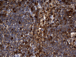 NME1 Antibody in Immunohistochemistry (Paraffin) (IHC (P))