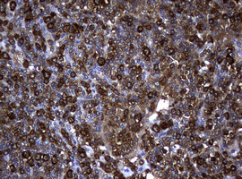 NME1 Antibody in Immunohistochemistry (Paraffin) (IHC (P))