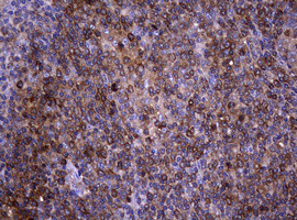 NME1 Antibody in Immunohistochemistry (Paraffin) (IHC (P))