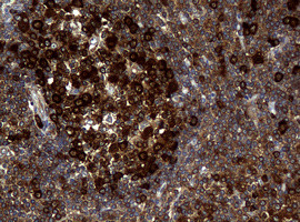 NME1 Antibody in Immunohistochemistry (Paraffin) (IHC (P))