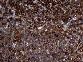 NME1 Antibody in Immunohistochemistry (Paraffin) (IHC (P))
