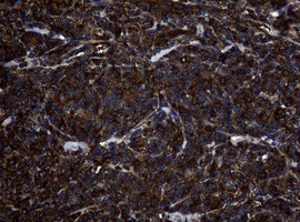 NME1 Antibody in Immunohistochemistry (Paraffin) (IHC (P))
