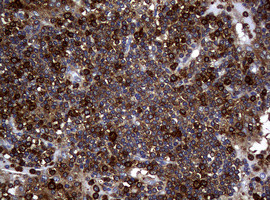 NME1 Antibody in Immunohistochemistry (Paraffin) (IHC (P))