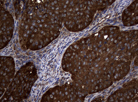 NME1 Antibody in Immunohistochemistry (Paraffin) (IHC (P))