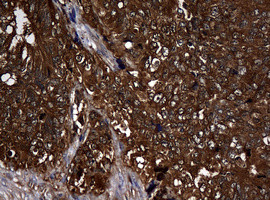 NME1 Antibody in Immunohistochemistry (Paraffin) (IHC (P))