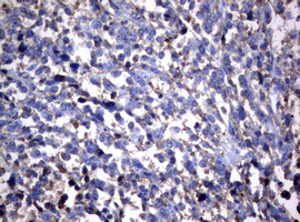 NME1 Antibody in Immunohistochemistry (Paraffin) (IHC (P))