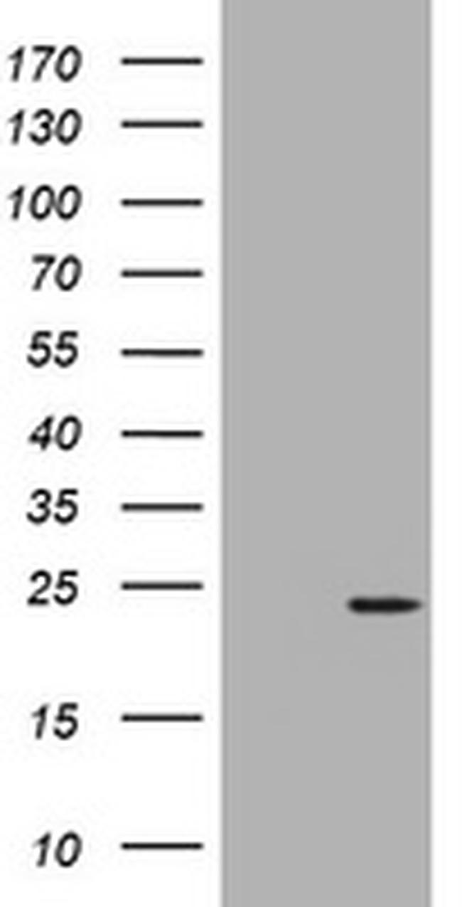 NME1 Antibody in Western Blot (WB)