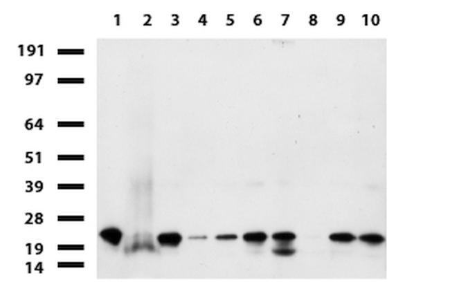 NME1 Monoclonal Antibody (UMAB92) (UM800023CF)